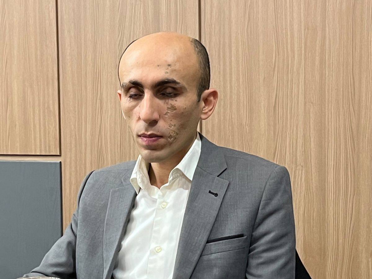 Artak Beglarjan erblindete, als er als Kind auf eine Mine trat. Später wurde er Minister in der international nicht anerkannten «Republik Arzach» und schaffte in letzter Minute die Flucht vor dem aserbaidschanischen Militär. 